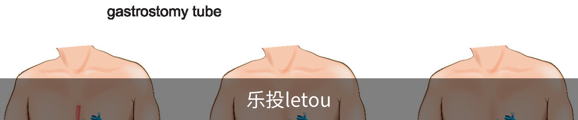 乐投letou
